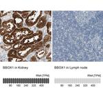 BBOX1 Antibody in Immunohistochemistry (IHC)
