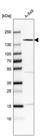 FNDC3B Antibody in Western Blot (WB)