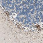 ABCA3 Antibody in Immunohistochemistry (IHC)