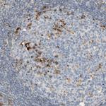 CECR1 Antibody in Immunohistochemistry (IHC)