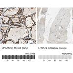 LPCAT2 Antibody in Immunohistochemistry (IHC)