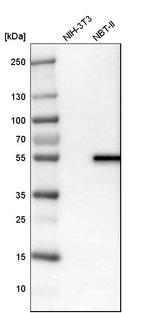 LPCAT2 Antibody in Western Blot (WB)