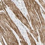 P4HA3 Antibody in Immunohistochemistry (IHC)