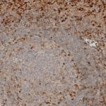 VISTA Antibody in Immunohistochemistry (IHC)