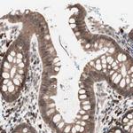 ALG5 Antibody in Immunohistochemistry (IHC)