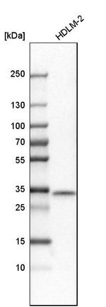 STX11 Antibody in Western Blot (WB)