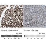 UQCRC2 Antibody in Immunohistochemistry (IHC)