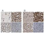 UQCRC2 Antibody in Immunohistochemistry (IHC)