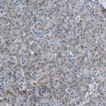 UQCRC2 Antibody in Immunohistochemistry (IHC)