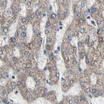 UQCRC2 Antibody in Immunohistochemistry (IHC)