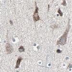 UQCRC2 Antibody in Immunohistochemistry (IHC)