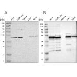 UQCRC2 Antibody in Western Blot (WB)