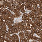 GPD2 Antibody in Immunohistochemistry (IHC)