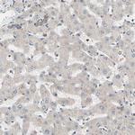 GPD2 Antibody in Immunohistochemistry (IHC)