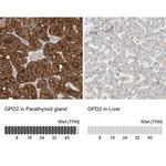 GPD2 Antibody