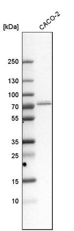 GPD2 Antibody in Western Blot (WB)