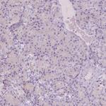 A4GNT Antibody in Immunohistochemistry (IHC)