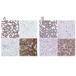 CEL Antibody in Immunohistochemistry (IHC)