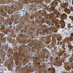 CEL Antibody in Immunohistochemistry (IHC)