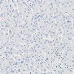 CEL Antibody in Immunohistochemistry (IHC)