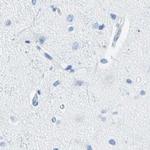 CEL Antibody in Immunohistochemistry (IHC)