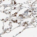 FMNL1 Antibody in Immunohistochemistry (IHC)