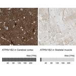 ATP6V1B2 Antibody