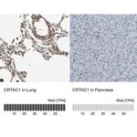 CRTAC1 Antibody