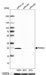 PSMA2 Antibody in Western Blot (WB)