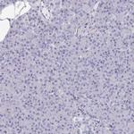 OMG Antibody in Immunohistochemistry (IHC)