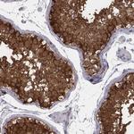 ISYNA1 Antibody in Immunohistochemistry (IHC)