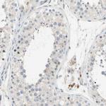 GAS6 Antibody in Immunohistochemistry (IHC)