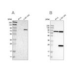 ALDH18A1 Antibody in Western Blot (WB)