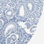 PPBP Antibody in Immunohistochemistry (IHC)