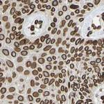 UNC84A Antibody in Immunohistochemistry (IHC)