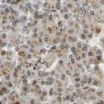 UNC84A Antibody in Immunohistochemistry (IHC)