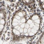 UNC84A Antibody in Immunohistochemistry (IHC)