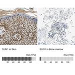 UNC84A Antibody