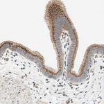 TMF1 Antibody in Immunohistochemistry (IHC)