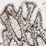 FUS Antibody in Immunohistochemistry (IHC)