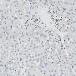 FUS Antibody in Immunohistochemistry (IHC)