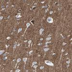 Neurofascin Antibody in Immunohistochemistry (IHC)