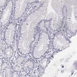 ADAM7 Antibody in Immunohistochemistry (IHC)