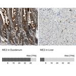 ME2 Antibody in Immunohistochemistry (IHC)