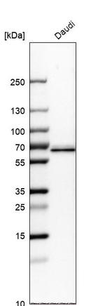 ME2 Antibody in Western Blot (WB)