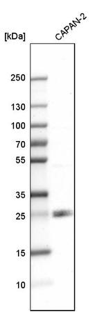 p27 Antibody in Western Blot (WB)