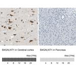 B4GALNT1 Antibody in Immunohistochemistry (IHC)