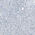 B4GALNT1 Antibody in Immunohistochemistry (IHC)