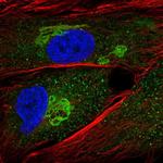 GALNT5 Antibody in Immunocytochemistry (ICC/IF)