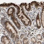 GALNT5 Antibody in Immunohistochemistry (IHC)